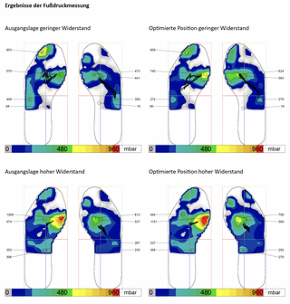 Auch die Druckverteilung an den Füßen wird genau erfasst