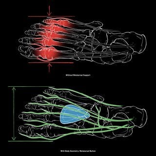 Der „Metatarsal Button“ in der Sohle hebt die Knochen im Vorfuß